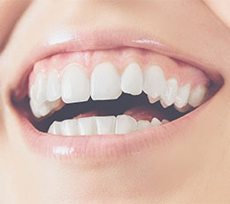 Comment utiliser le Siwak pour les dents ? - Ma santé bucco-dentaire
